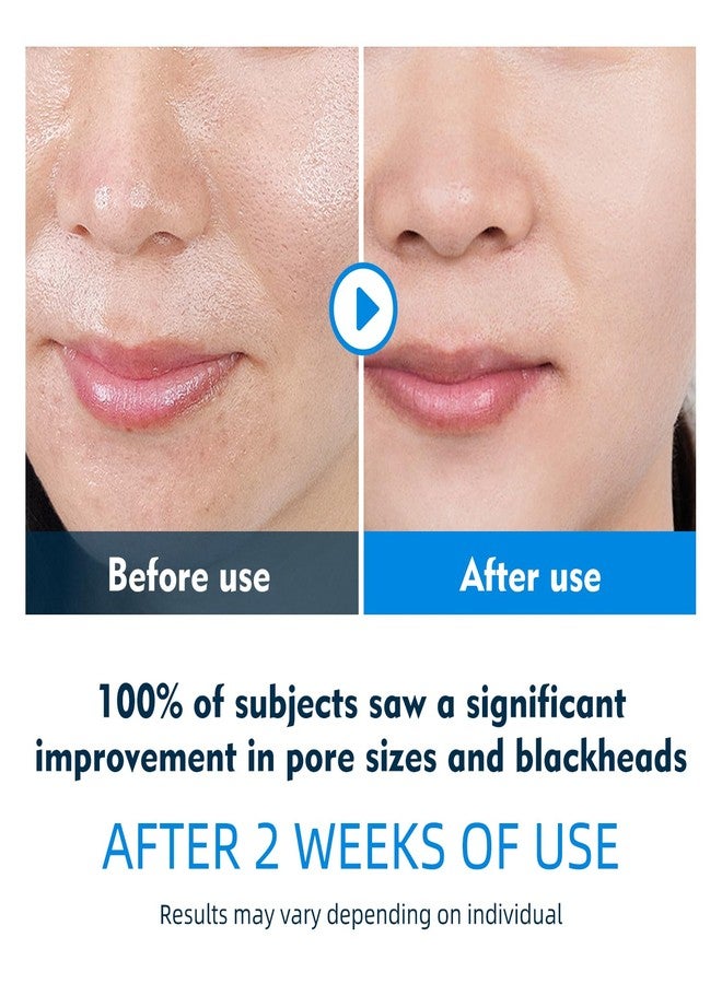 IREV Facial Toner Pads for Exfoliation and Pore Care with Hyaluronic Acid, Salicylic Acid, Collagen, Hydrating Facial Treatment, Pore Minimizer, Redness Relief, Radiant Skin, 100 Count - Image 2